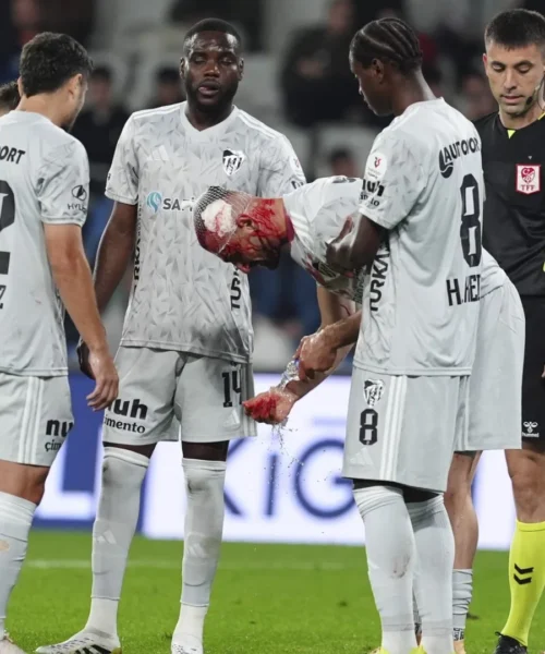 Tremendo colpo in testa, la ferita del calciatore è spaventosa. Foto