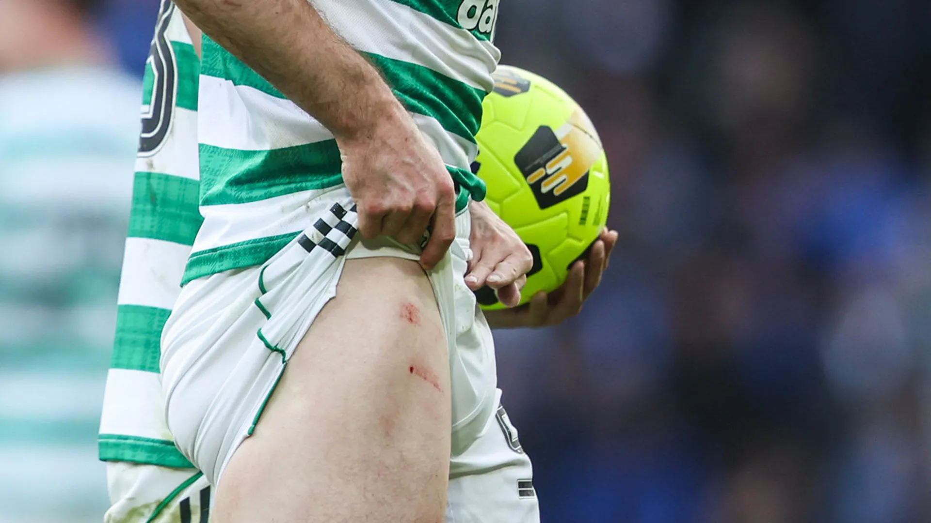 Ferisce l'avversario alla gamba: calciatore cacciato dal campo
