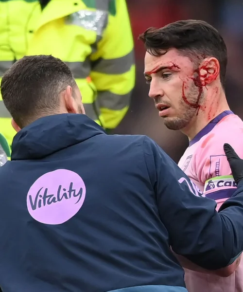 Agghiacciante testata: i due giocatori collassano a terra. Foto