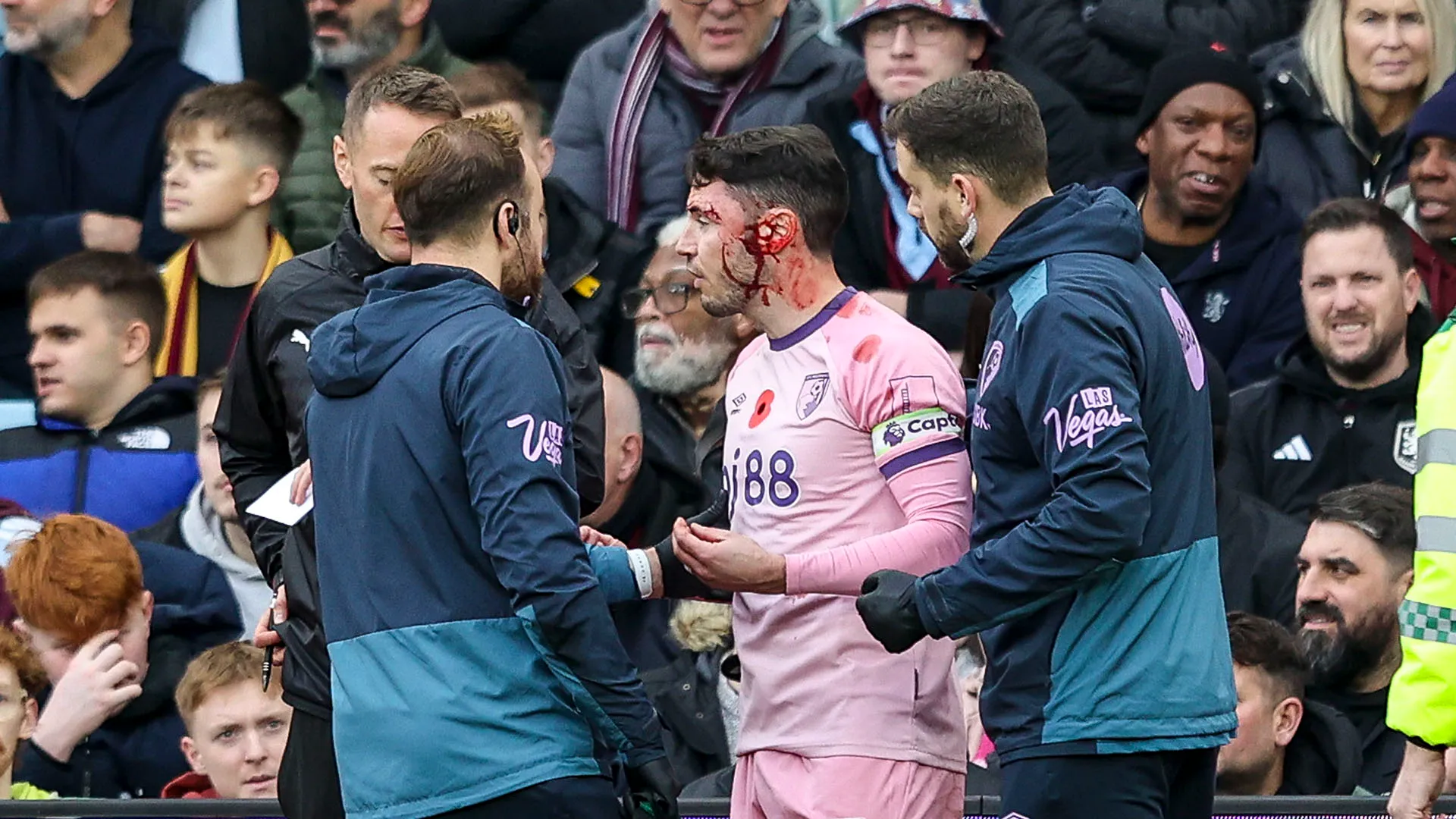 Per lui diversi punti di sutura e una possibile concussione