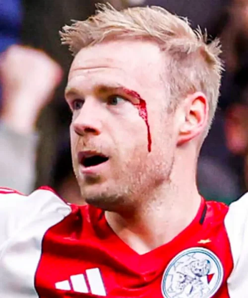 Ferito alla testa mentre esulta dopo il gol, le foto del grande spavento