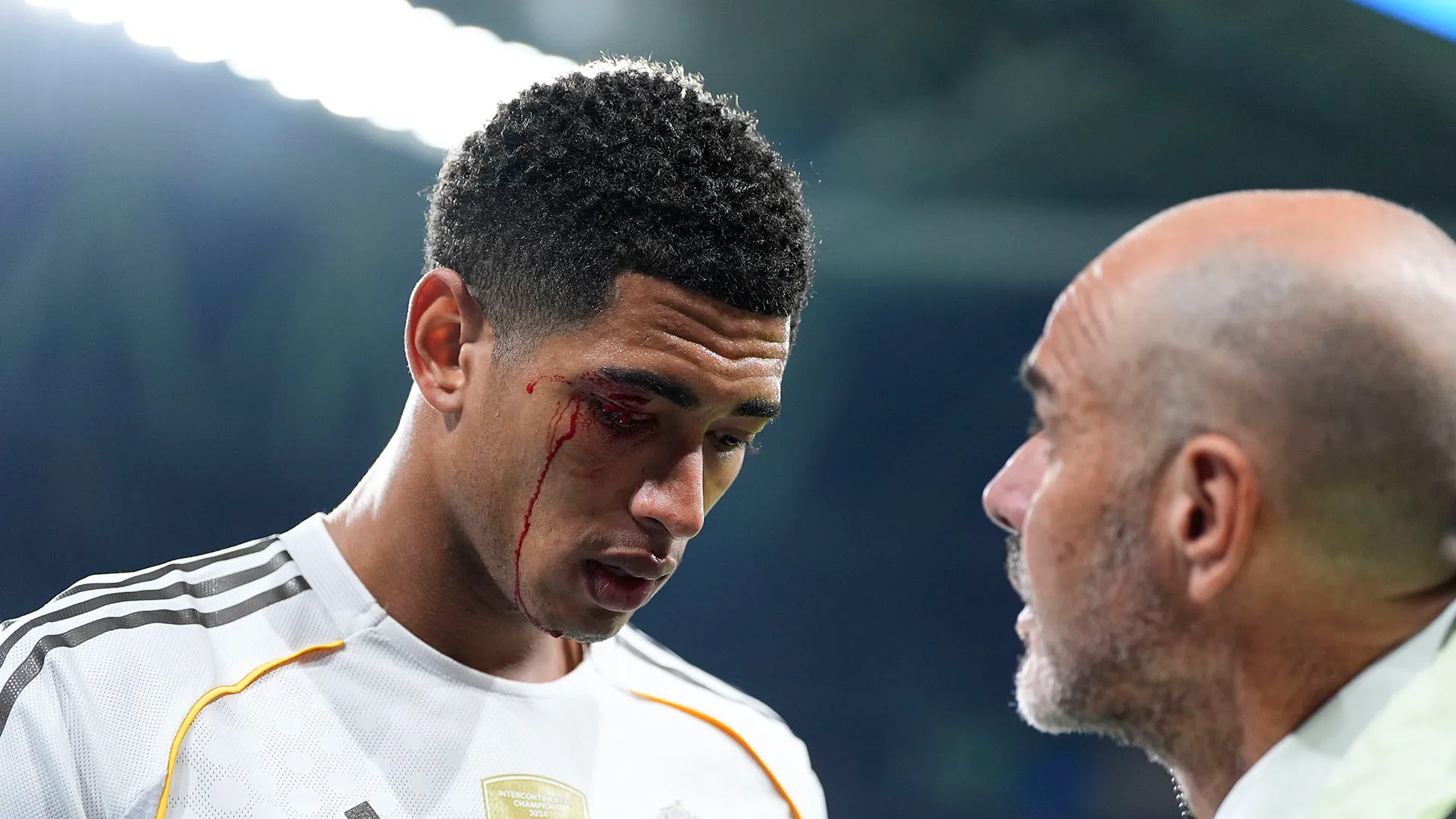 Enorme spavento per Jude Bellingham: sangue dall'occhio dopo la gomitata
