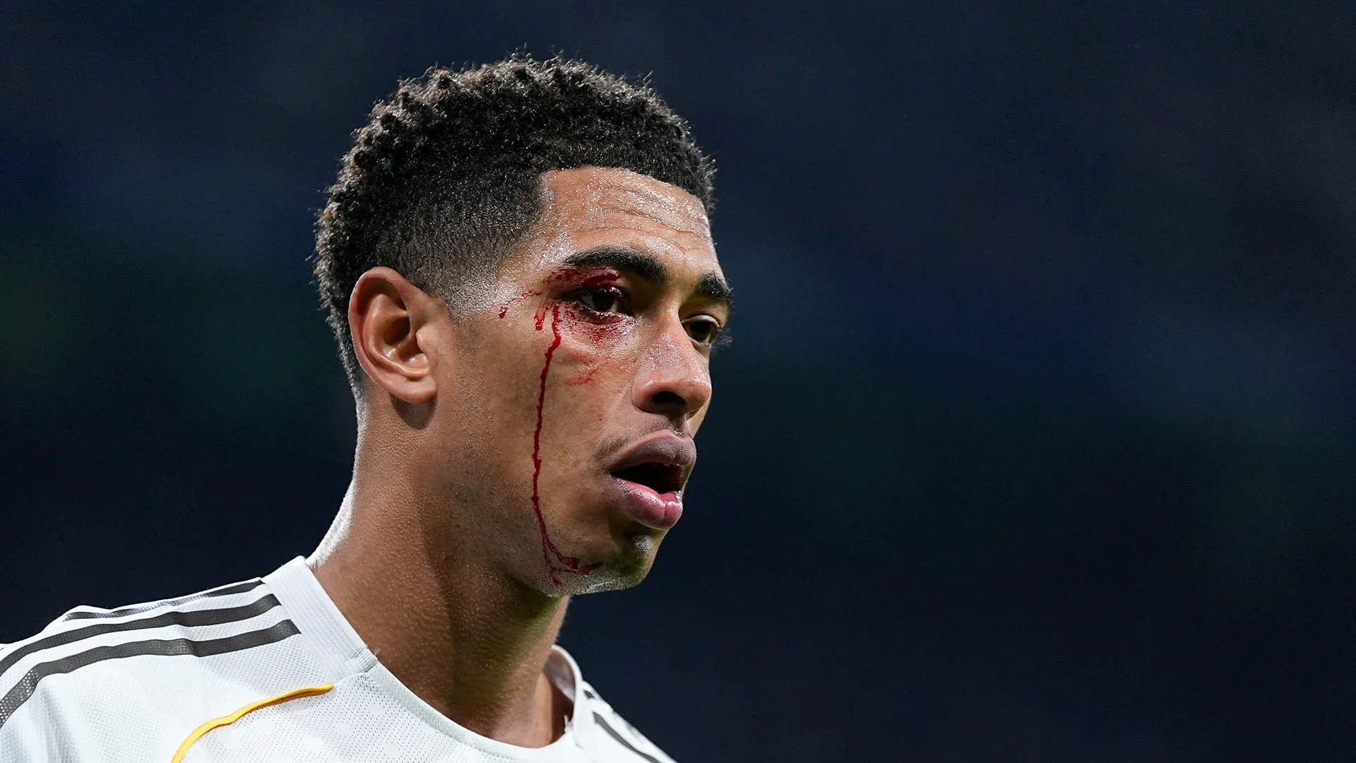 Il calciatore del Real Madrid ha ricevuto un durissimo colpo durante la sfida con il Celta Vigo
