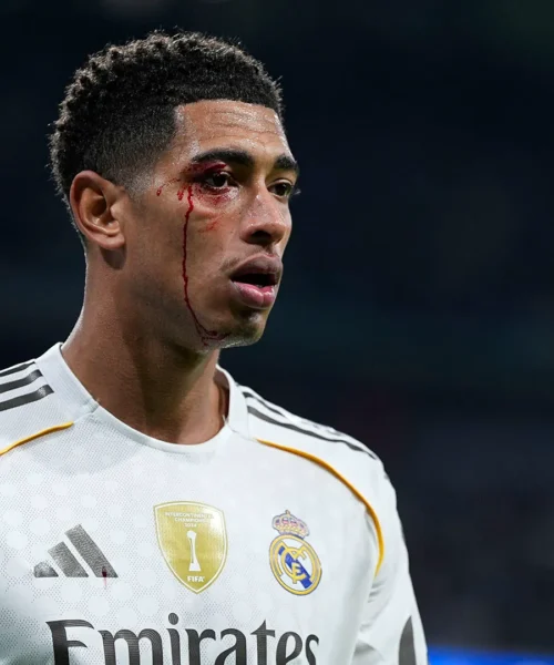 Enorme spavento per Jude Bellingham: sangue dall’occhio dopo la gomitata. Foto