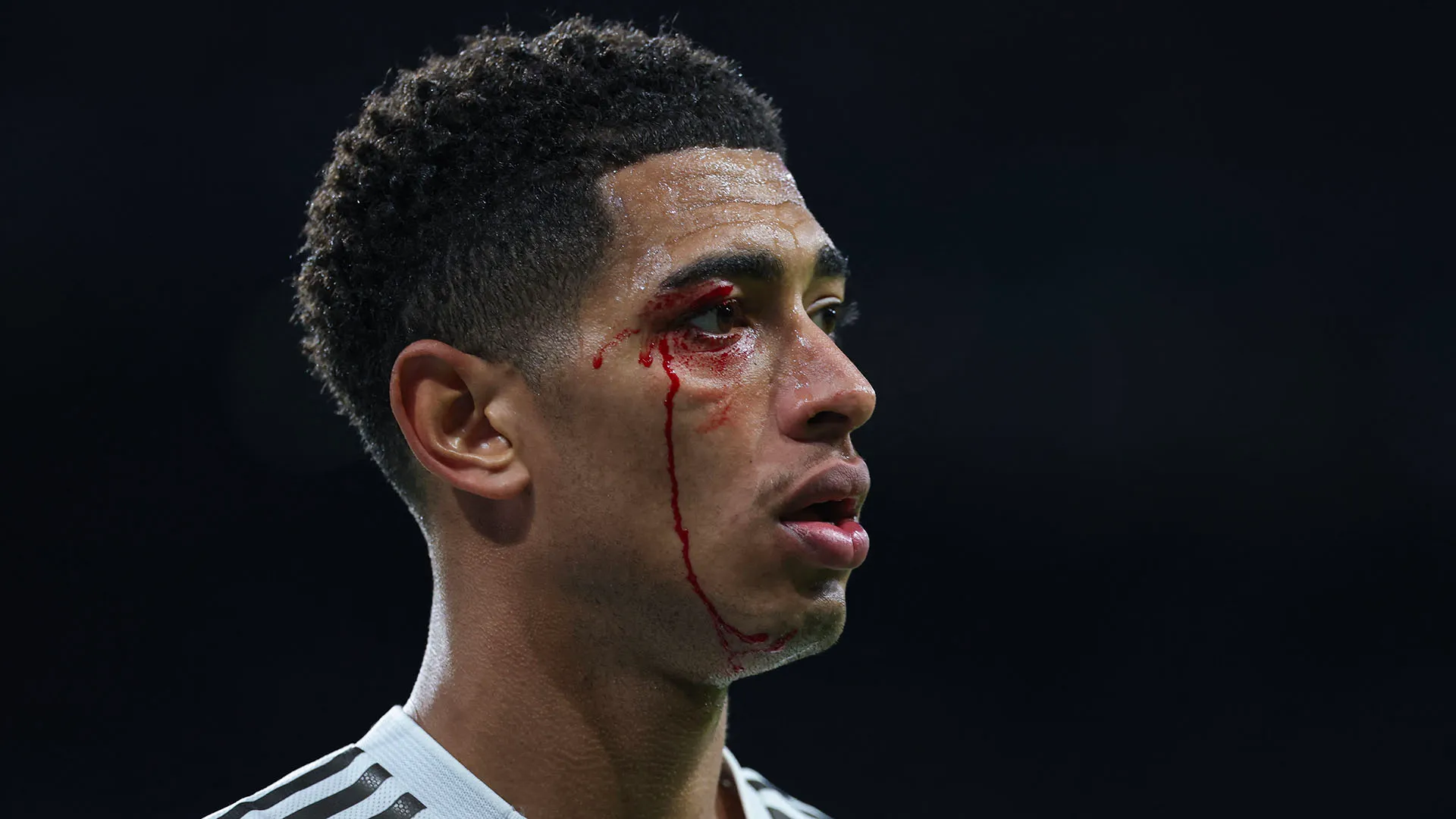 Chiaramente l'arbitro ha dovuto interrompere il gioco per permettere l'ingresso dei dottori
