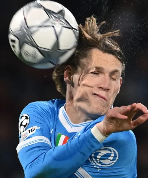 Tremenda botta in faccia per Scott McTominay: le foto del grande spavento