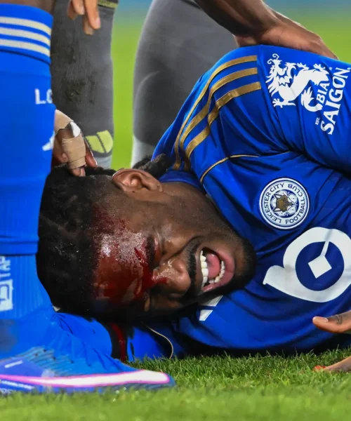Sangue dalla testa e urla disperate, le foto del tremendo infortunio