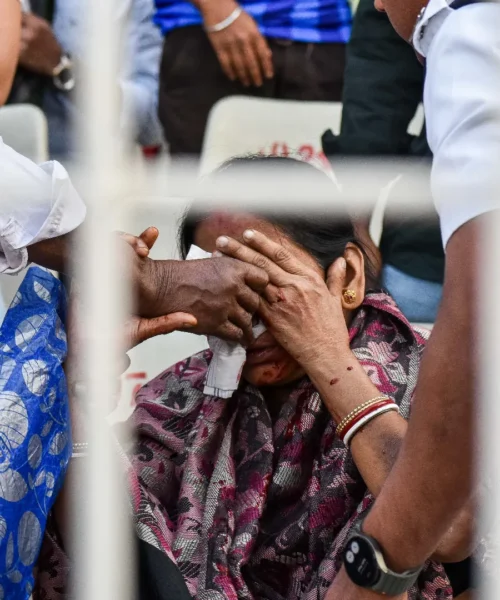 Volto coperto di sangue: le foto della tifosa colpita in faccia