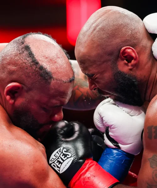 Vola via il parrucchino dopo il violento pugno: le foto