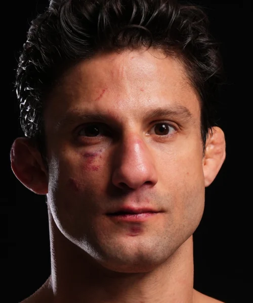 UFC sotto choc, è morto Allan Nascimento. Aveva solo 34 anni