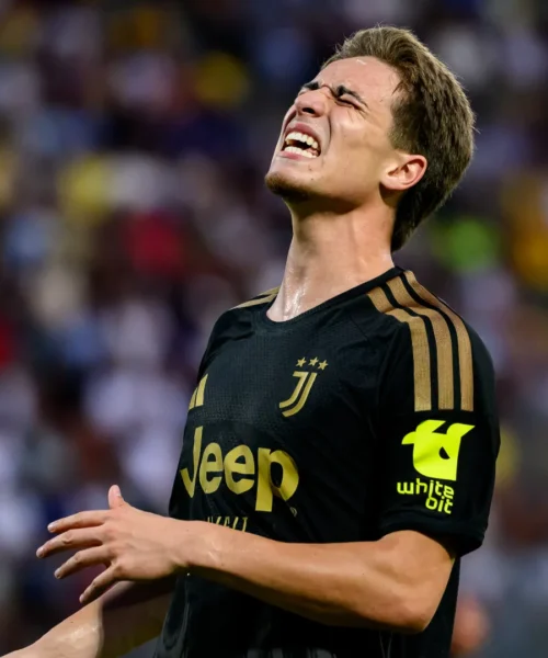Juventus, Yildiz fa tremare i tifosi: le sue condizioni