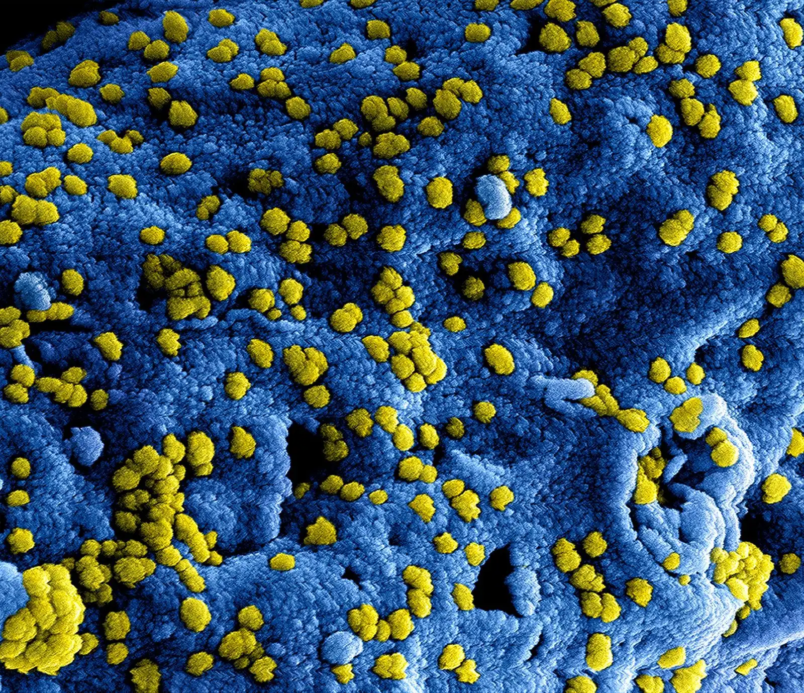 I virus che causano l’influenza mutano ogni anno: come funziona il contagio e come proteggersi